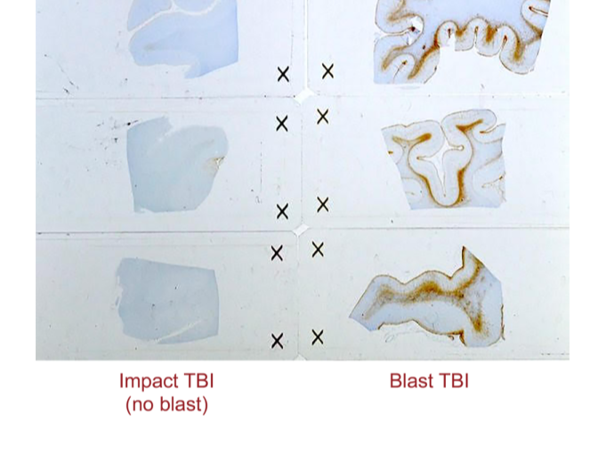 PANTHER Talk: Dr. Dan Perl on Blast Brain Pathology